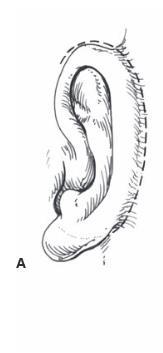 Elevation of framework 1