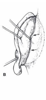 Elevation of framework 2