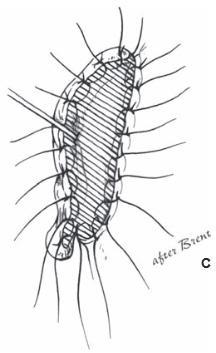 Elevation of framework 3