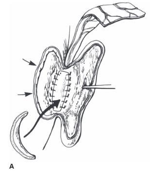 Elevation of framework A