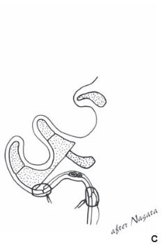 Elevation of framework C