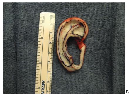 Construction of the cartilage