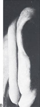 Congenital Anomalies 2