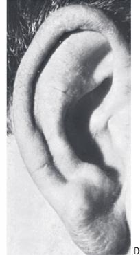 Congenital Anomalies 4