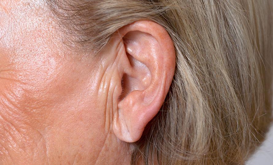saggy earlobes